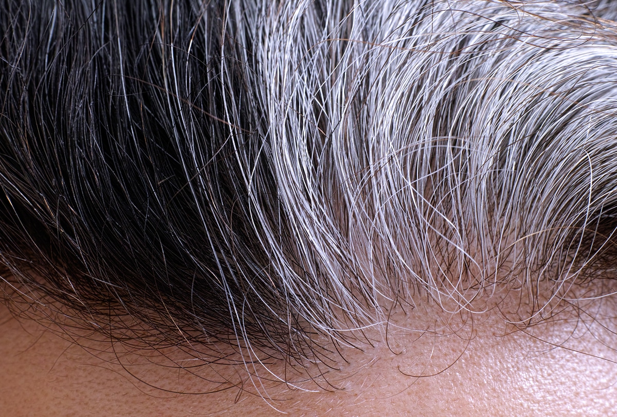 Onion Juice for Gray Hair: How It Works and How to Use It