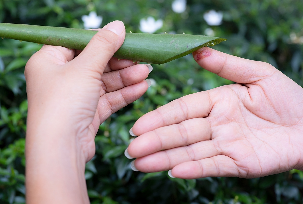 10 Home Remedies for Minor Wounds and How to Use Them