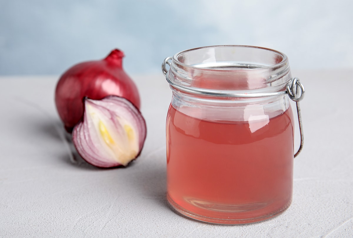 6 Ways to Use Onion Juice for Dandruff (Flaky Scalp)